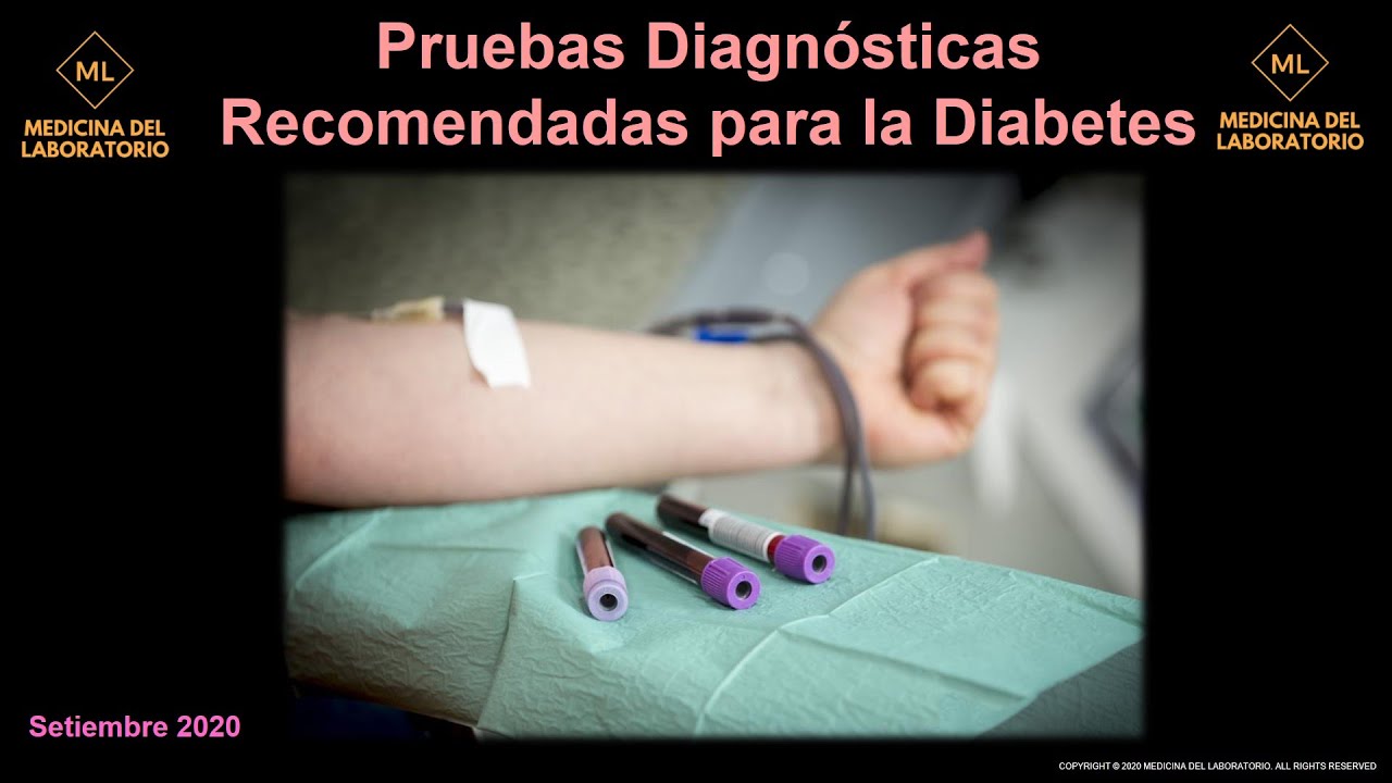 Pruebas de laboratorio recomendadas para el diagnóstico y monitorización de la Diabetes 2020