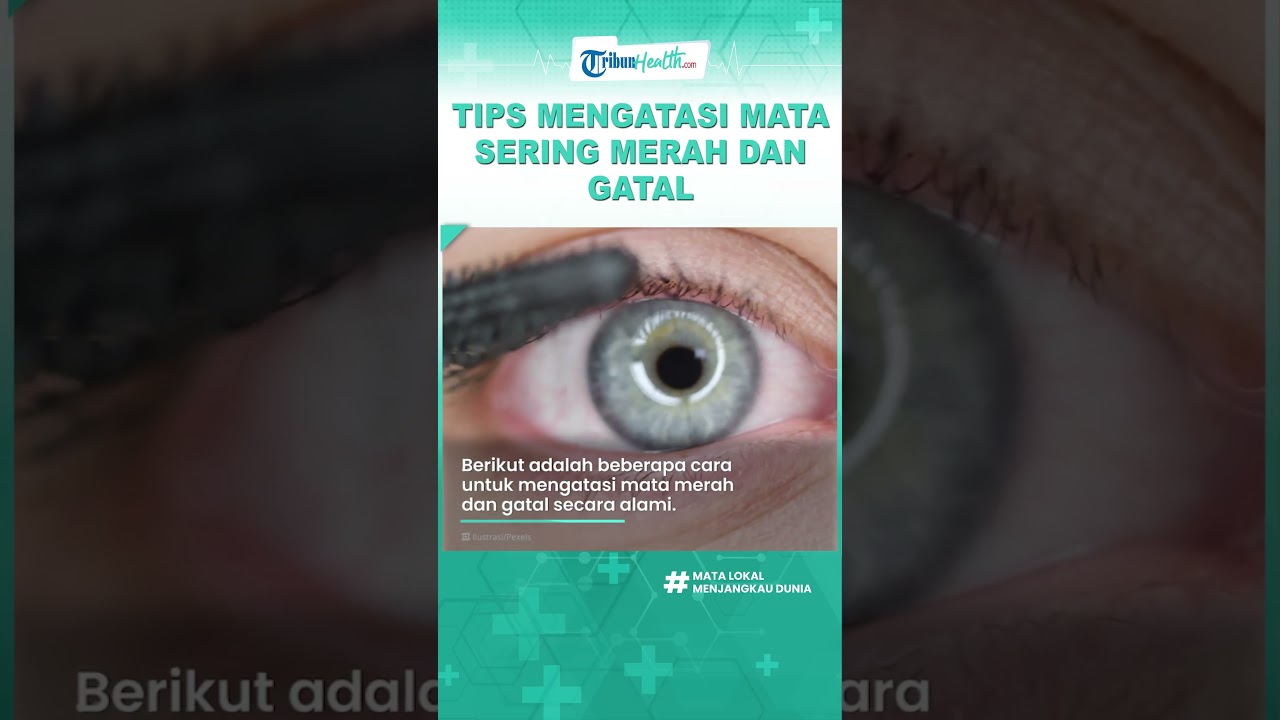 Mata Sering Merah dan Gatal? Jangan Disentuh, Lakukan Sederet Tips Berikut untuk Mengatasinya