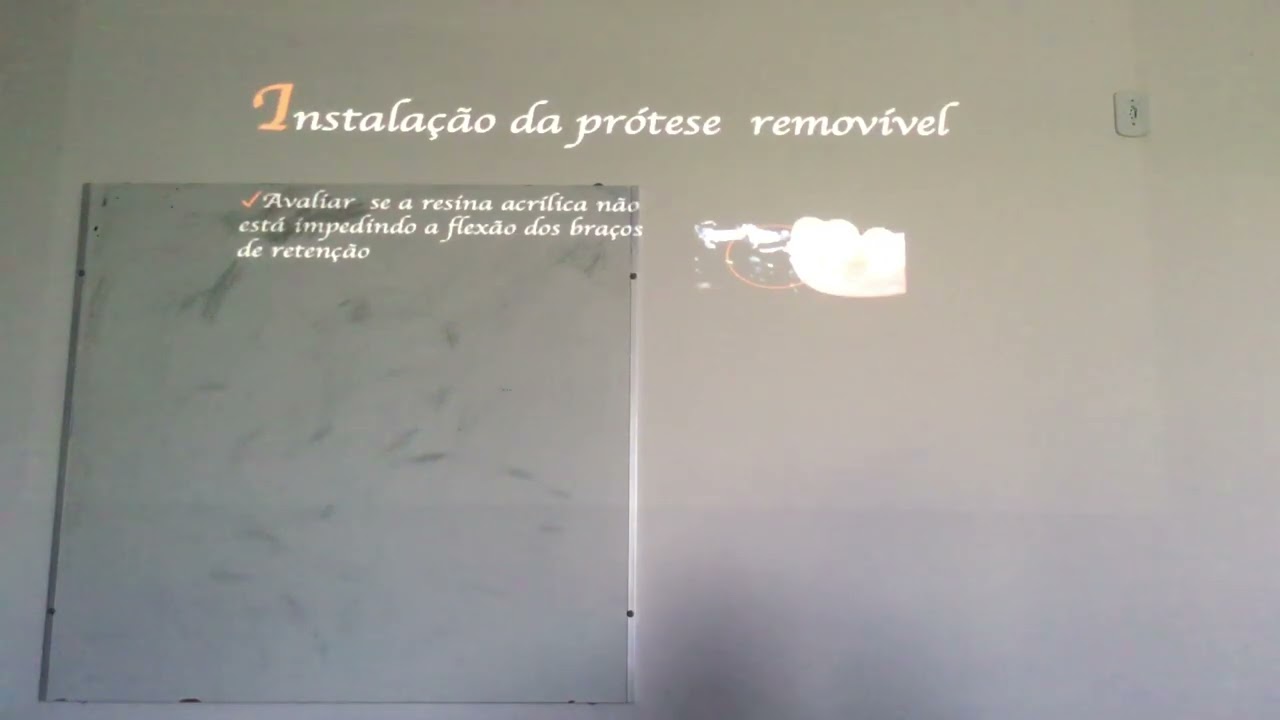 27. Instalação e controles da PPR. Prof. Eduardo Chorres. DOL UFS 17-04-23