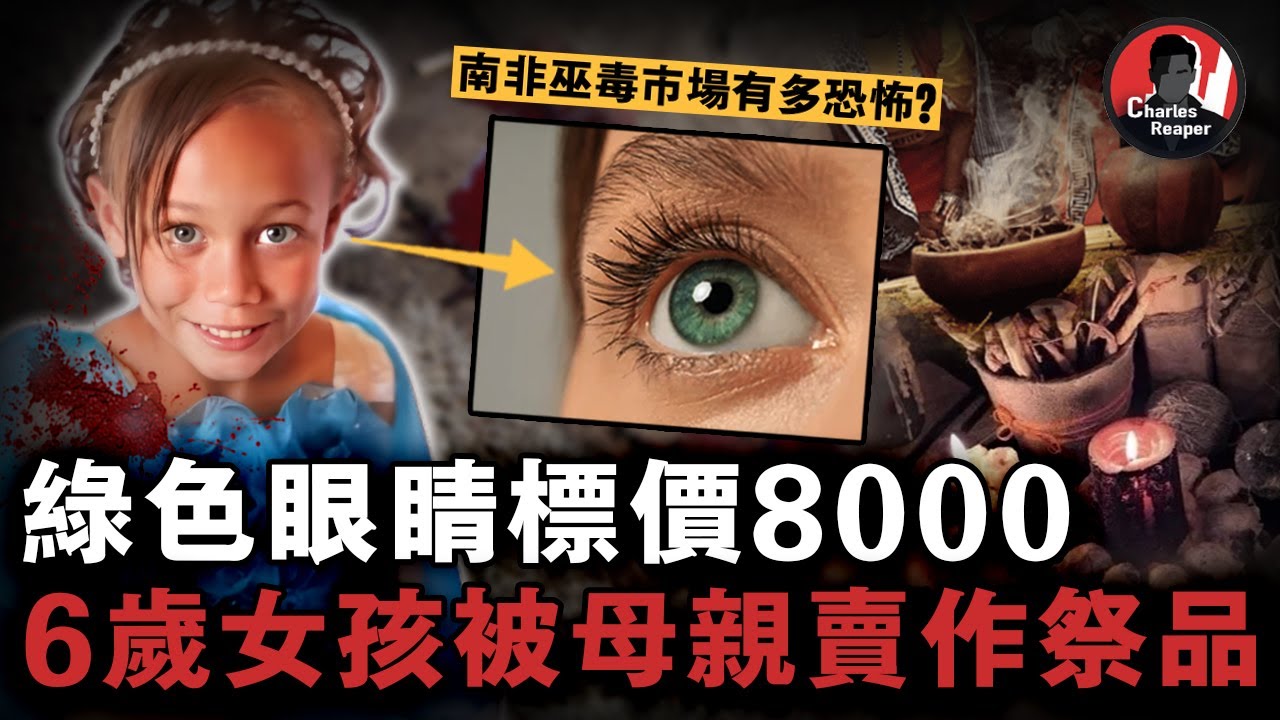 6歲「綠眼睛女孩」被母親賣給黑巫師做祭品招財！白化病人皮膚做藥包治百病？💀揭秘南非最黑暗恐怖的「巫毒市場」| 叫我查爾斯好了