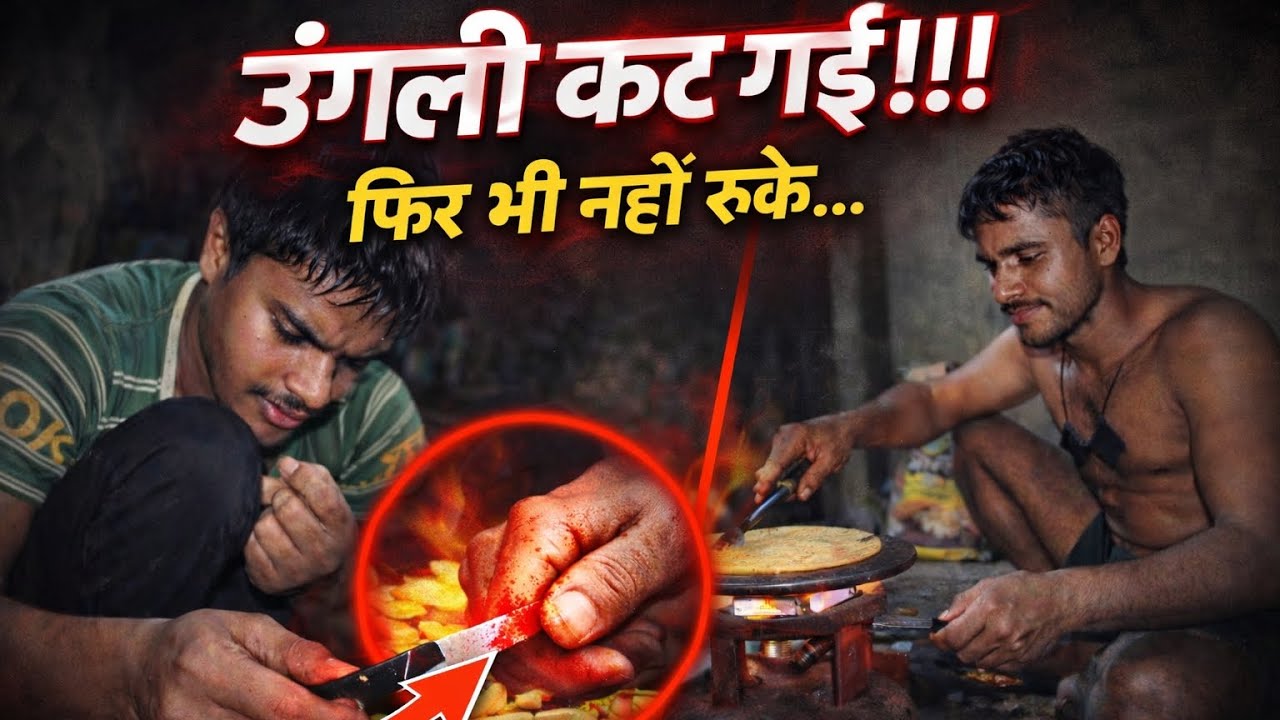 ड्यूटी आये तो भूखा लगी थी खाना बनाने लगे तो उगली कट गई है