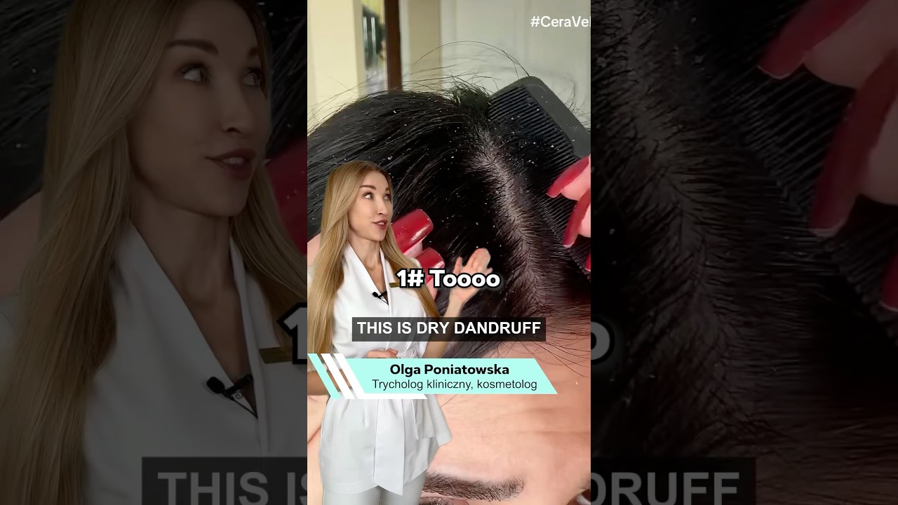 ⁉️Łupież, ŁZS czy łuszczyca⁉️