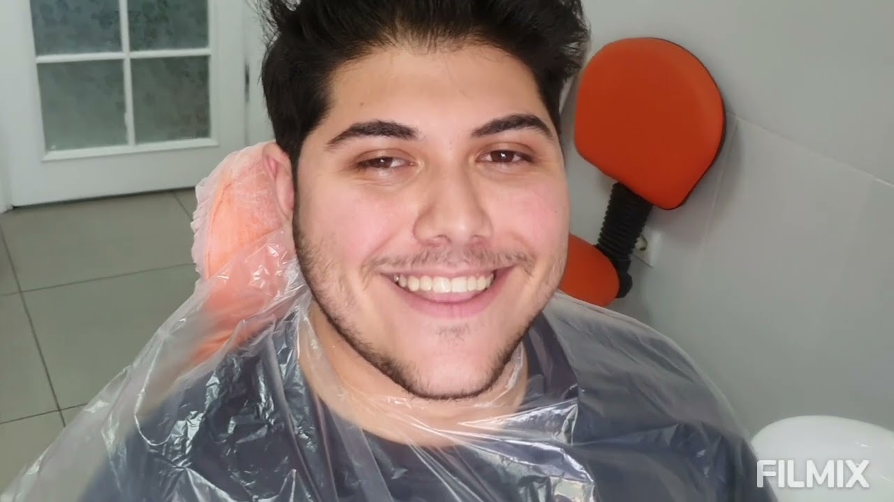 Alt çene önde olan hastada cerrahisiz fiber bondingle aralık diş tedavisi 4 aylık kontrol videosu