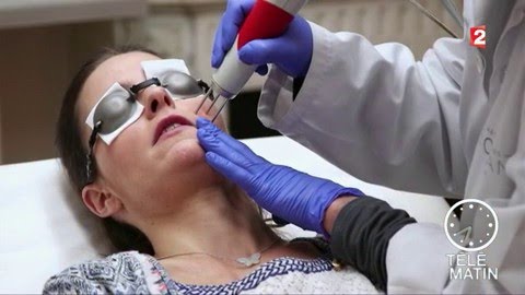 Santé - Du nouveau pour la rosacée
