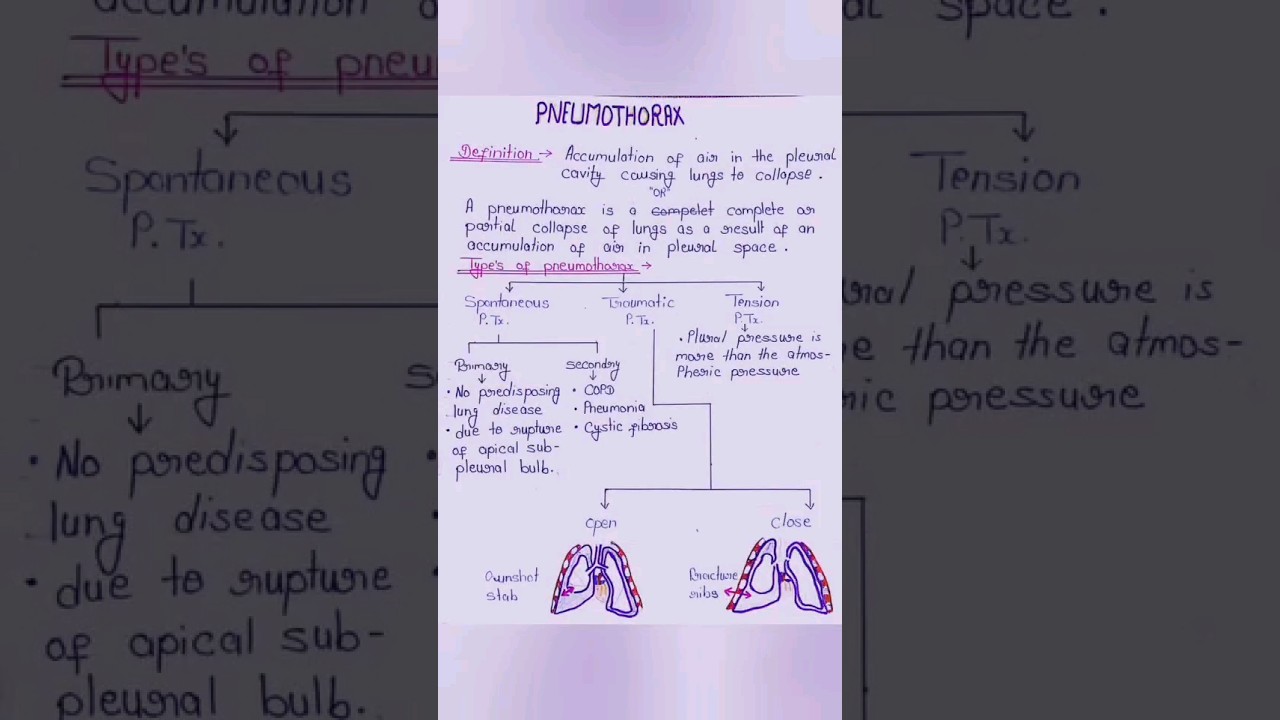 short notes - pneumothorax # easy notes #medicalnotes #easynotes #nursingstudent