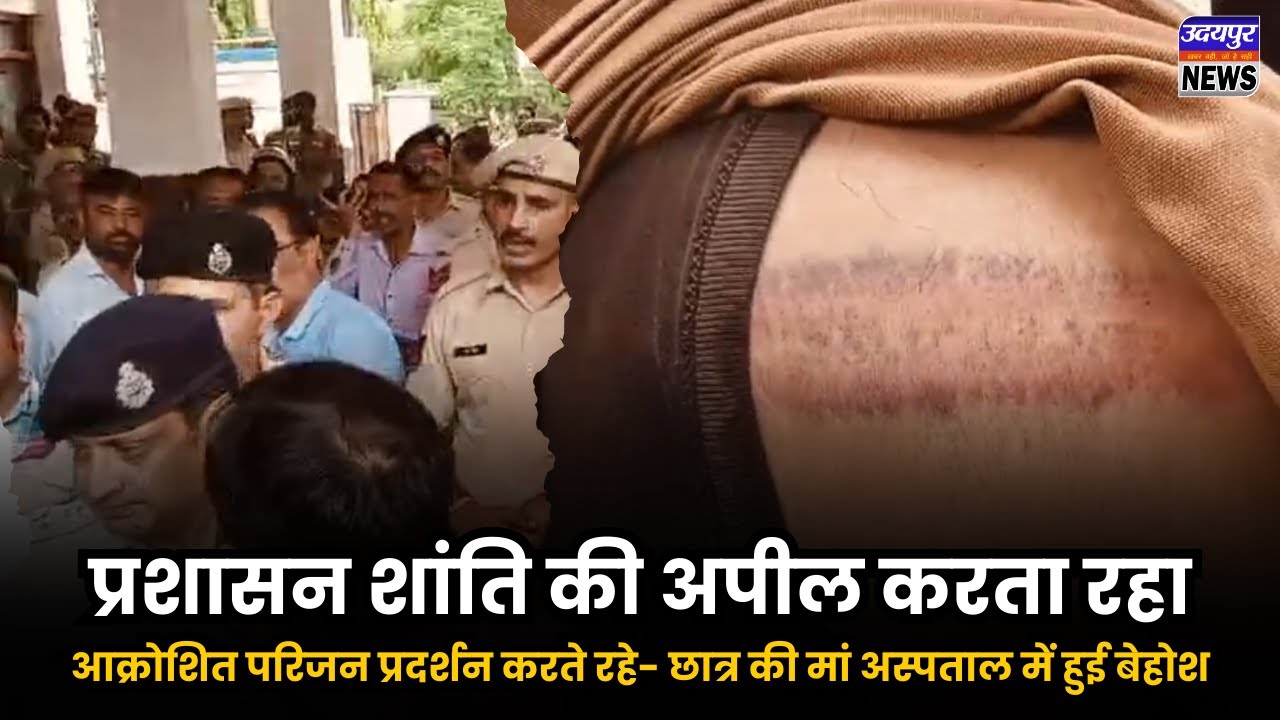 प्रशासन शांति की अपील करता रहा, आक्रोशित परिजन प्रदर्शन करते रहे- छात्र की मां अस्पताल में हुई बेहोश