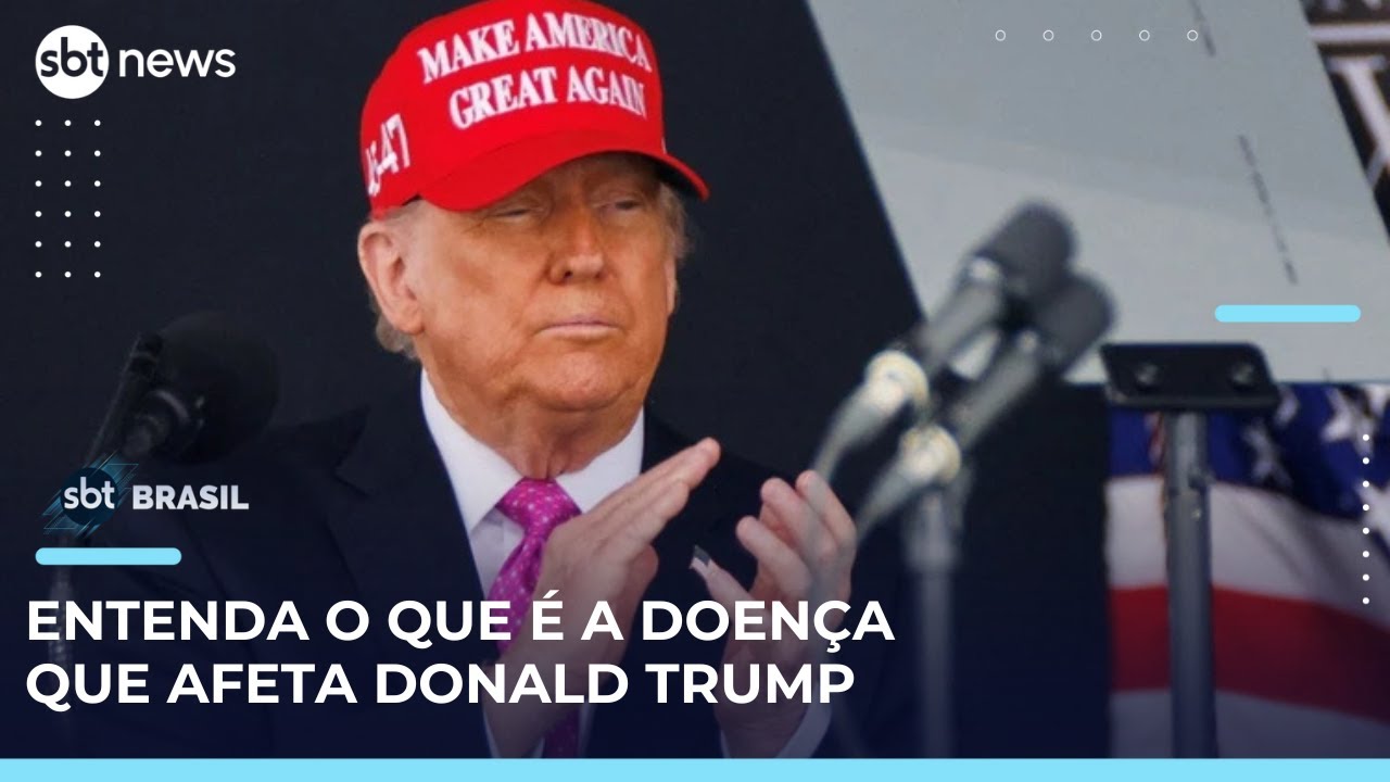Insuficiência venosa crônica: médico explica o tratamento da doença de Donald Trump | #SBTBrasil