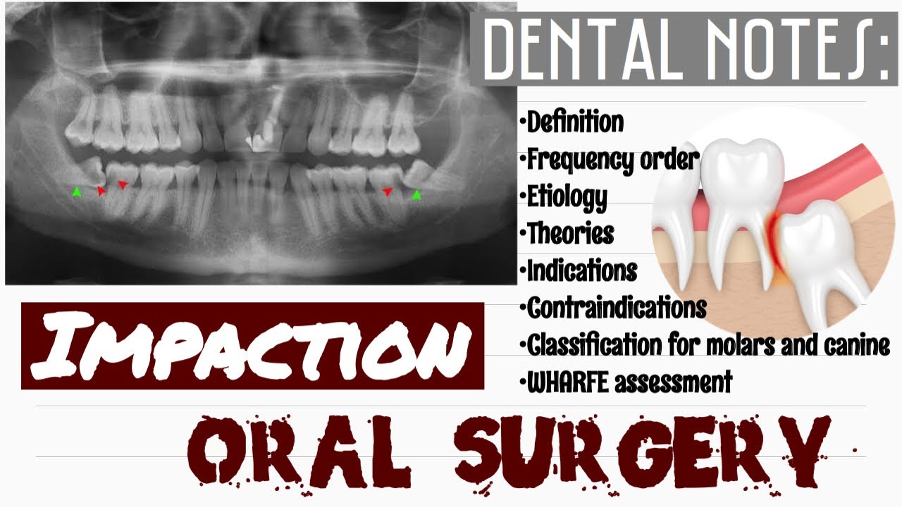 IMPACTION || ORAL SURGERY || DENTAL NOTES
