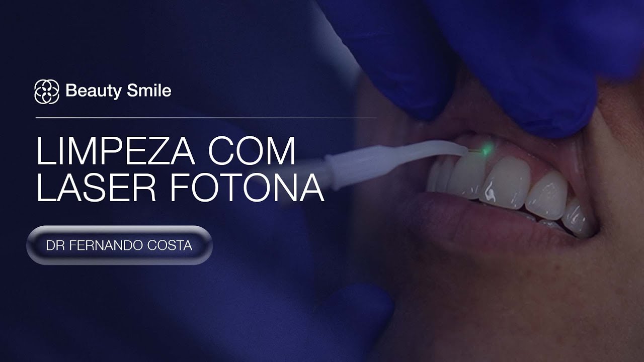 LIMPEZA ODONTOLOGICA COM LASER FOTONA
