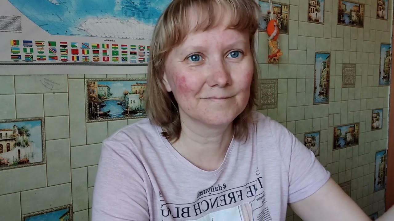 Розацеа. Проблема с кожей лица. Покраснения и демодекос.