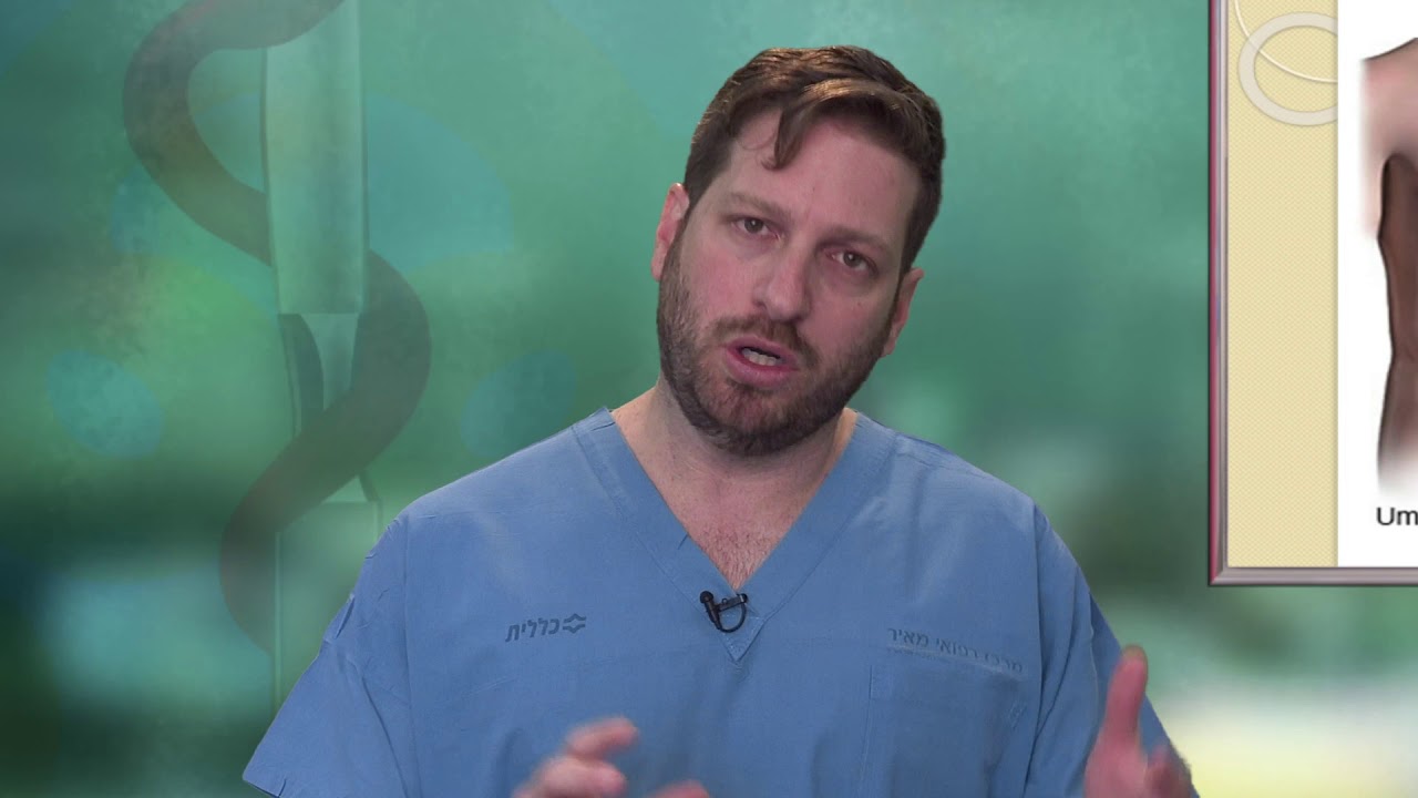 בקע טבורי - Umbilical Hernia