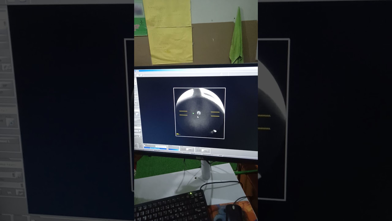 Taking fundus photo from fundus camera