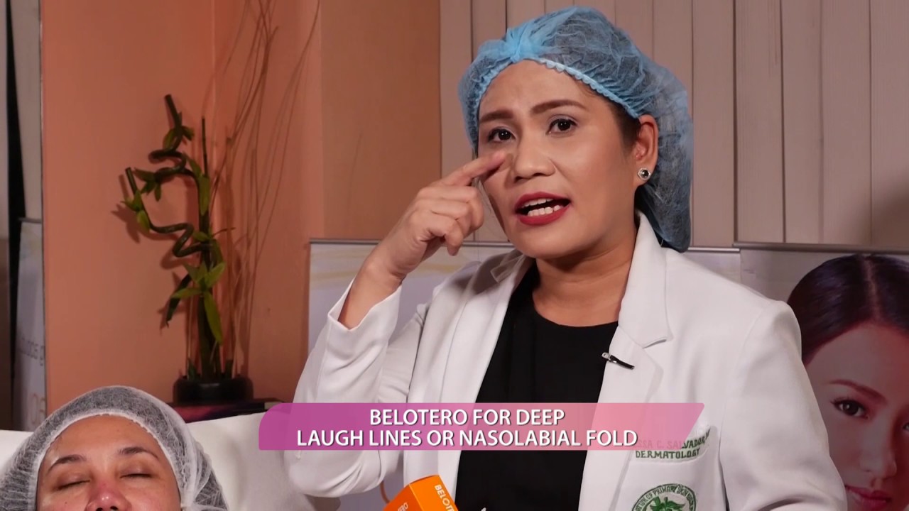 Nasolabial folds    Belotero
