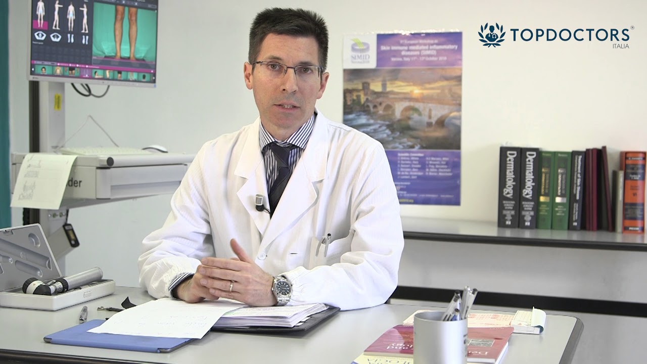 Psoriasi: sintomi e cure | Top Doctors