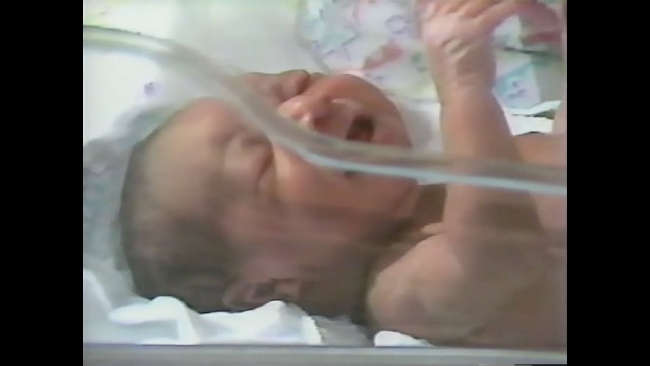 Neonatal Abstinence Syndrome