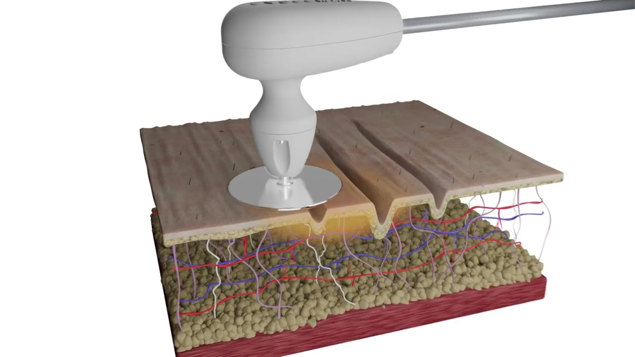 Vossman 3D