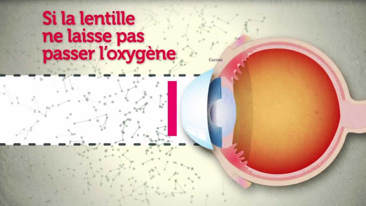 Lentilles de contact : attention les yeux !