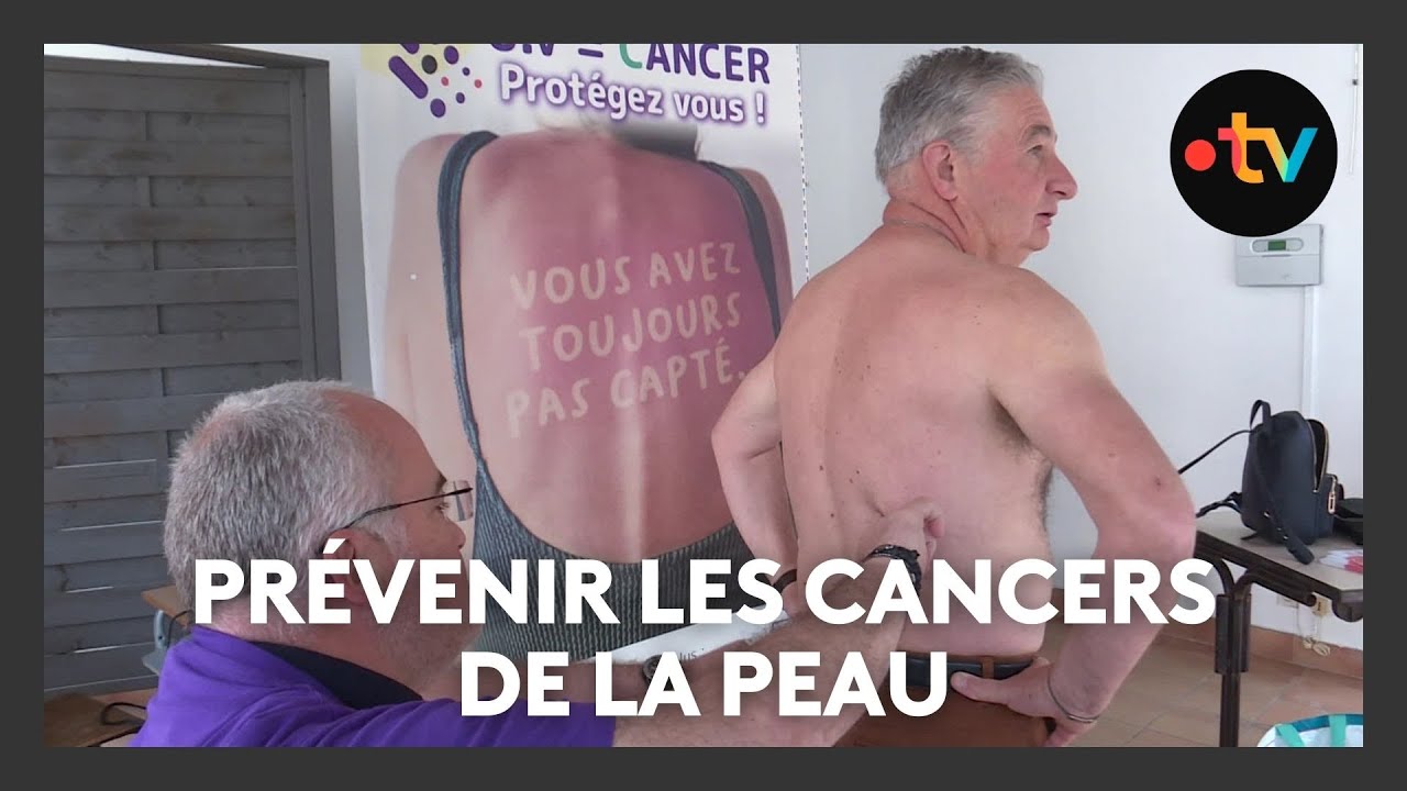 Mai violet : dépistage et prévention des cancers de la peau