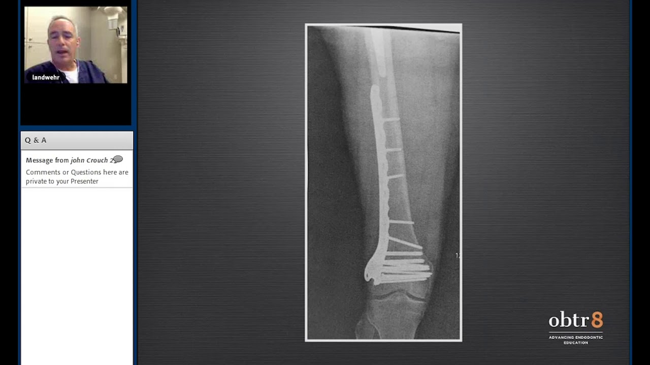 CBCT-Radiology Limitations & Diagnostic Dilemmas