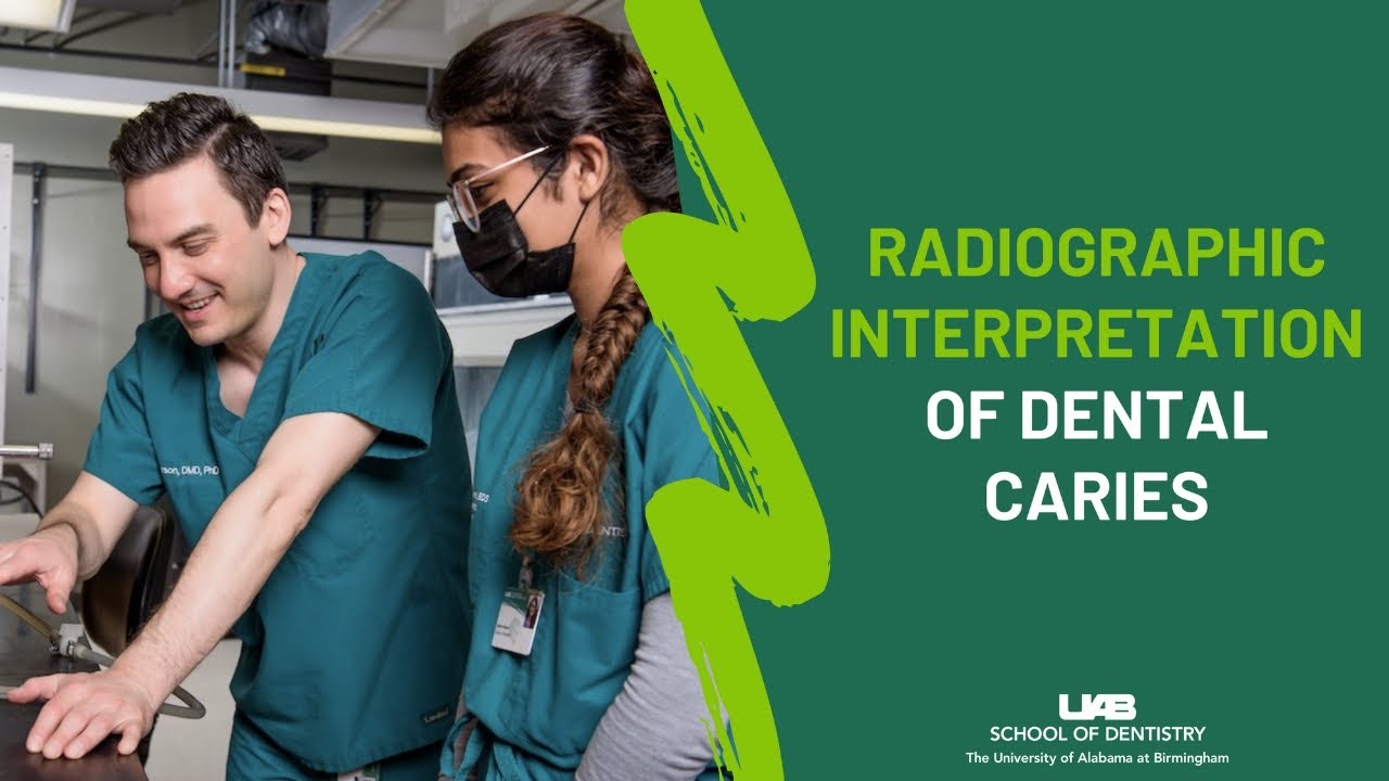 Radiographic Interpretation of Dental Caries