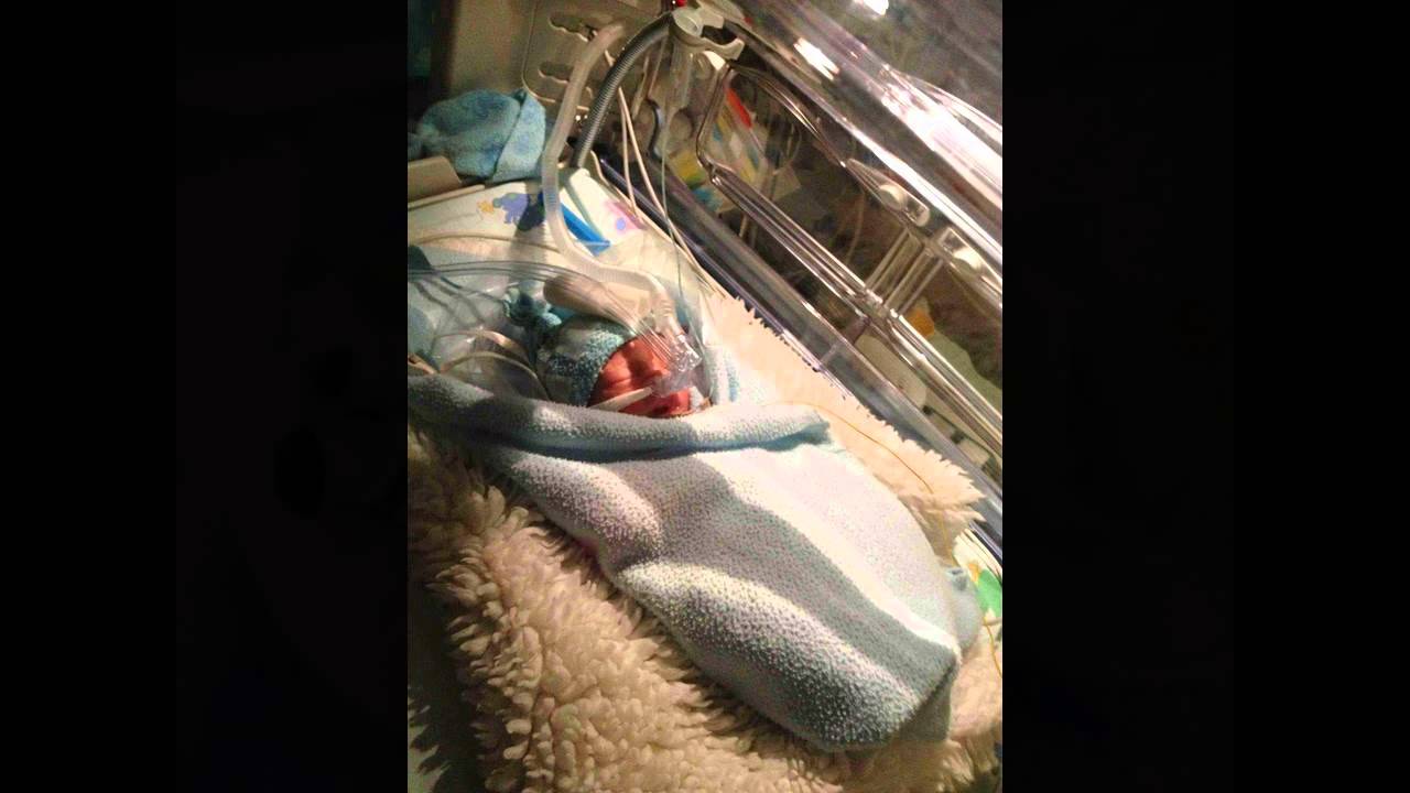 Mezinárodní den nedonošených dětí-2