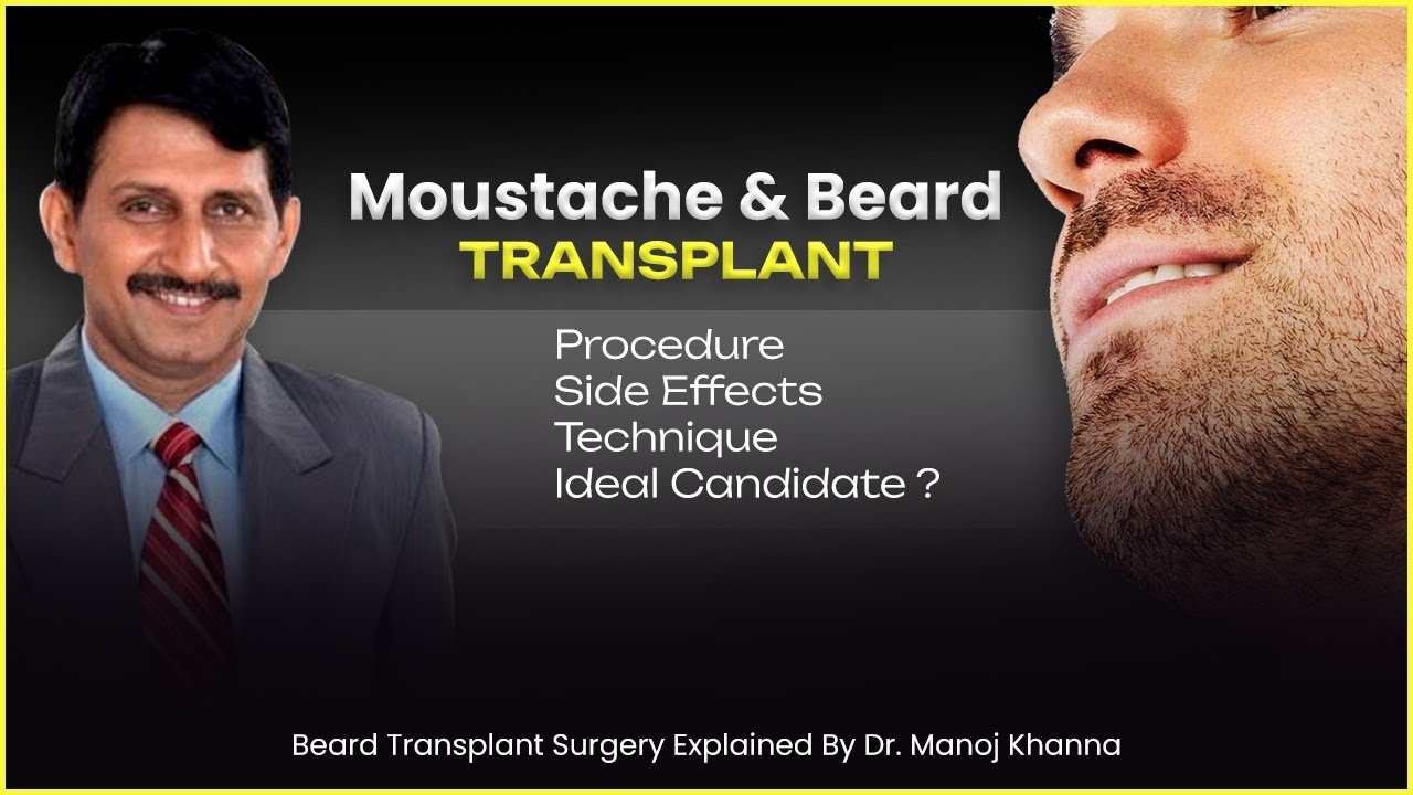 Moustache  & BeardTransplant in Kolkata. Dr. Manoj Khanna. #moustachetransplant #beardtransplant
