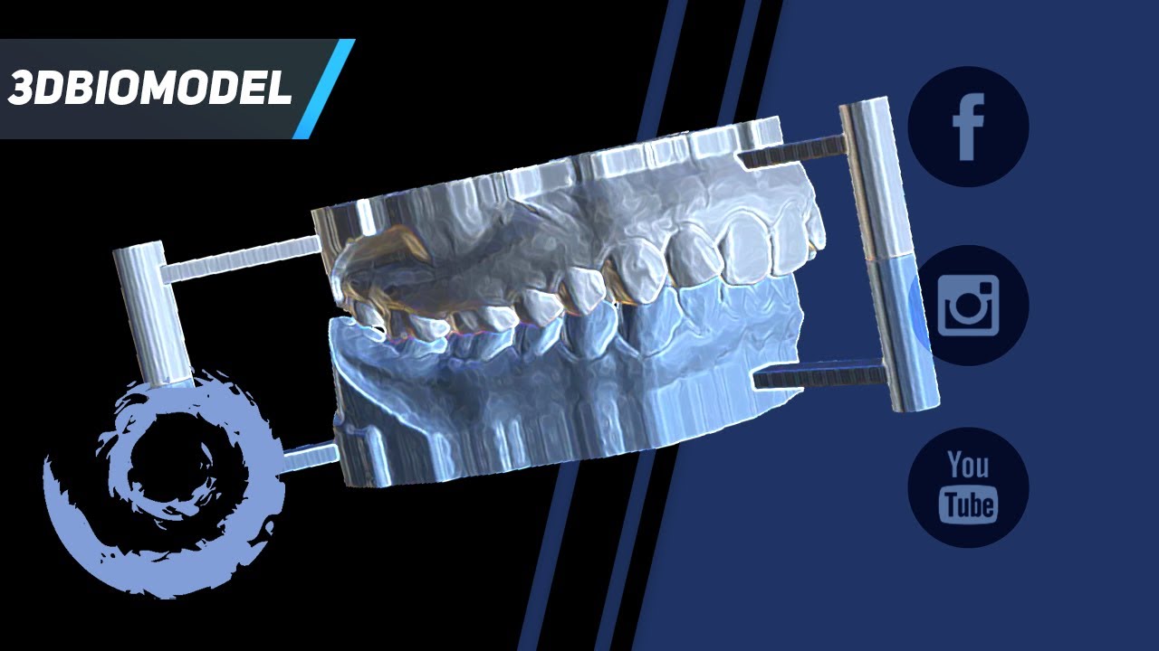 BlueSkyPlan 4.7 - Articolatore 3D in 5 minuti!