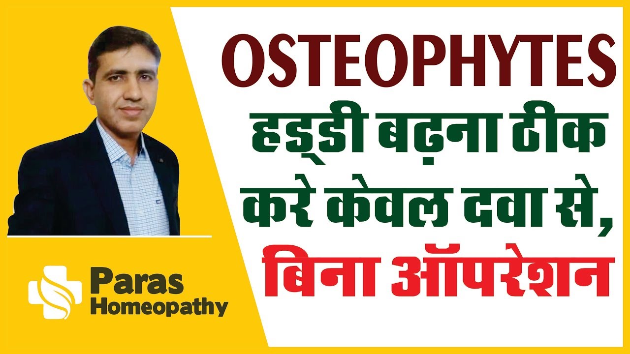 Osteophytes | हड्डी बढ़ने का कारण | Bone Spur | हड्डी बढ़ना ठीक करे केवल दवा से, बिना ऑपरेशन इलाज