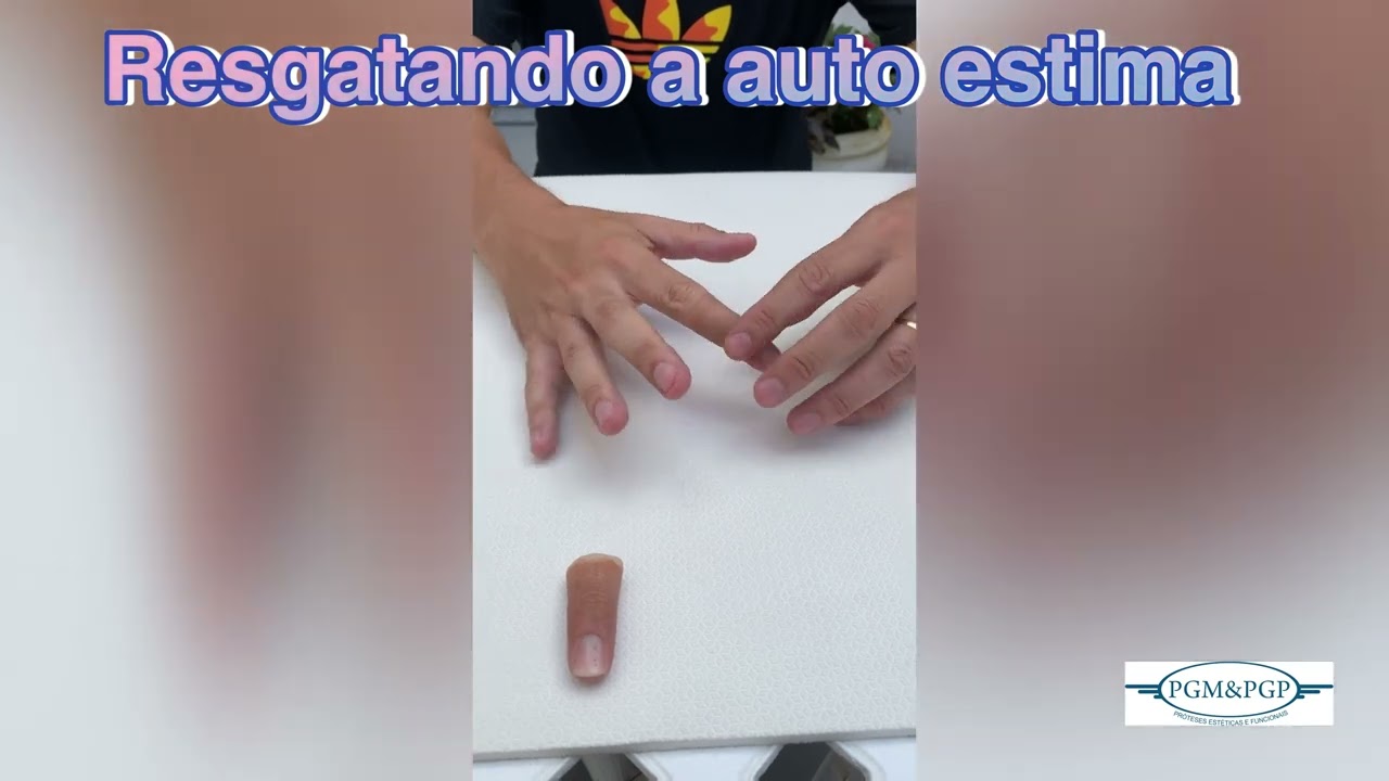 Prótese para dedo da mão