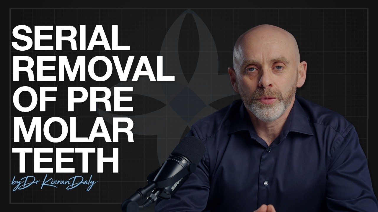 Serial removal of pre molar teeth | Orthodontics by Dr. Kieran Daly