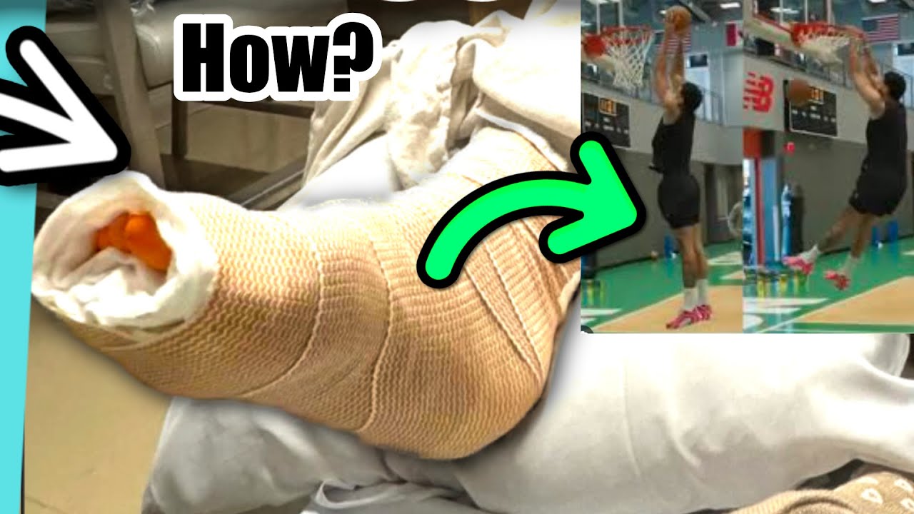 How Jayson Tatum Is Already Walking Without A Boot After an Achilles Tear