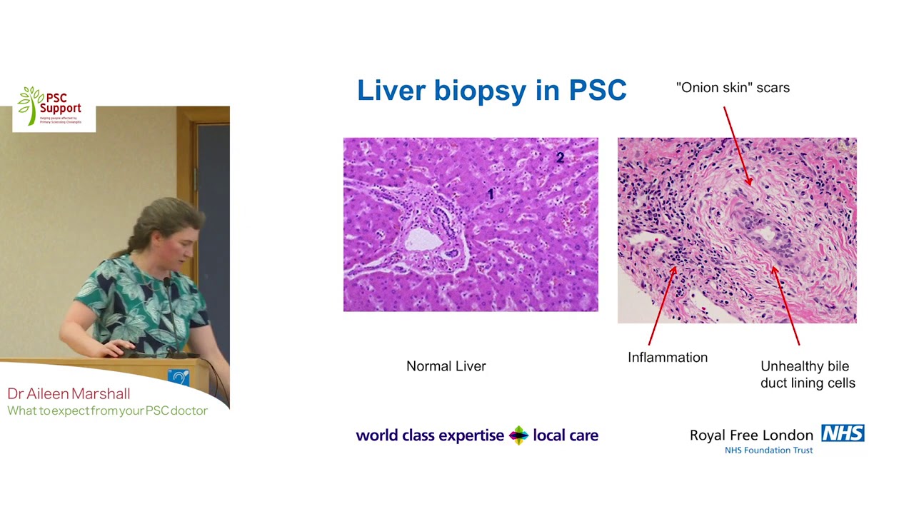 Dr Aileen Marshall - What to expect from your PSC doctor (PSC Support)