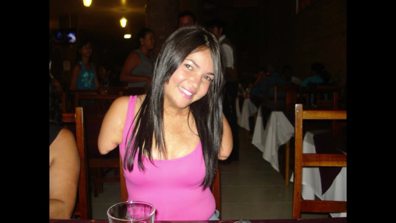 Amputee Pretty woman 02