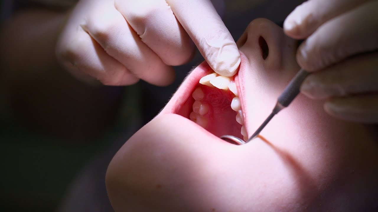 Dealing with anxiety at the dentist
