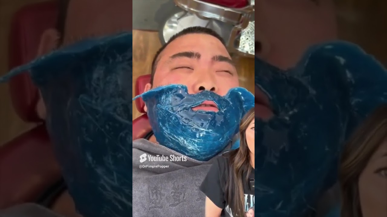 He Really Took It Like a CHAMP 🥇 #DrPimplePopper