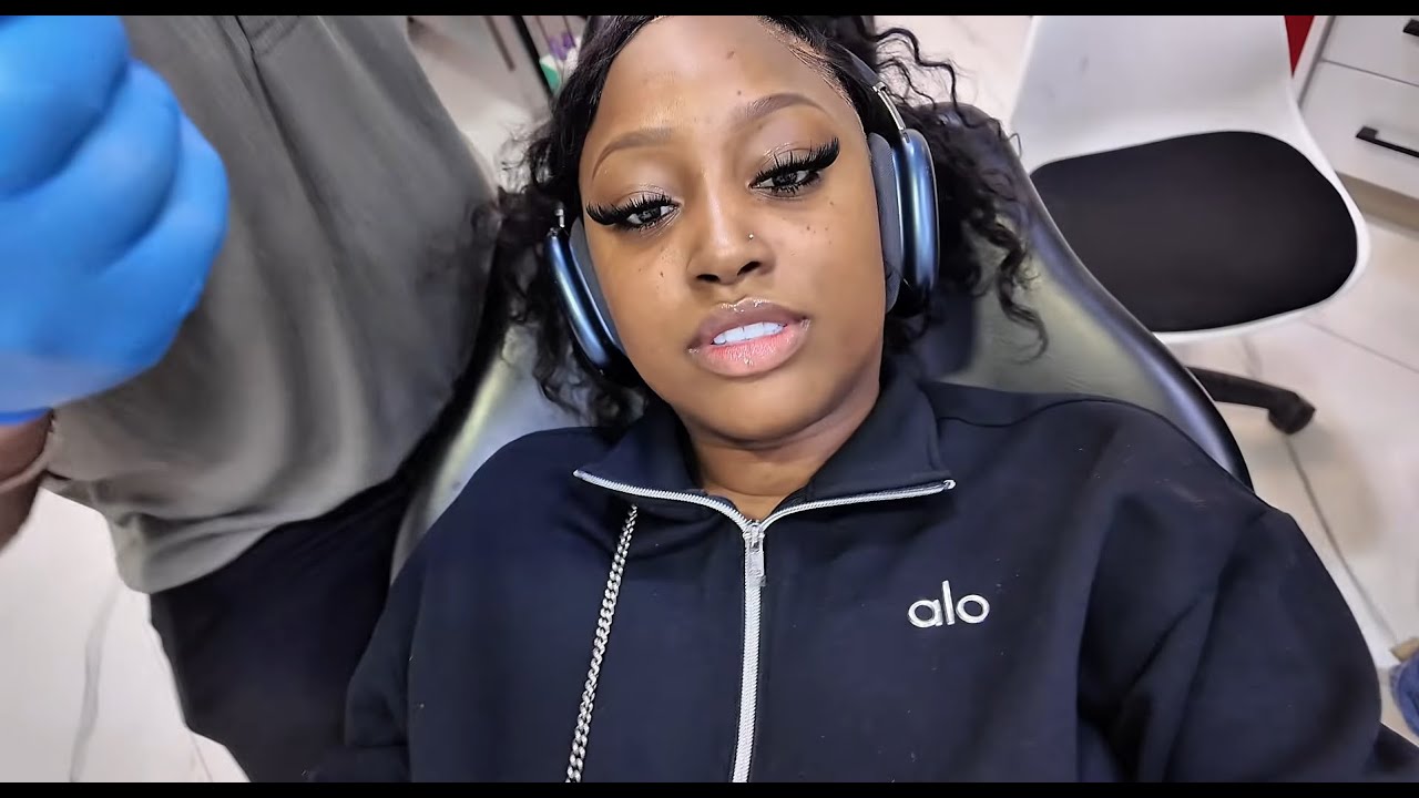 Composite Bonding Vlog by our lovely patient Mabinty Marie 🤍🦷