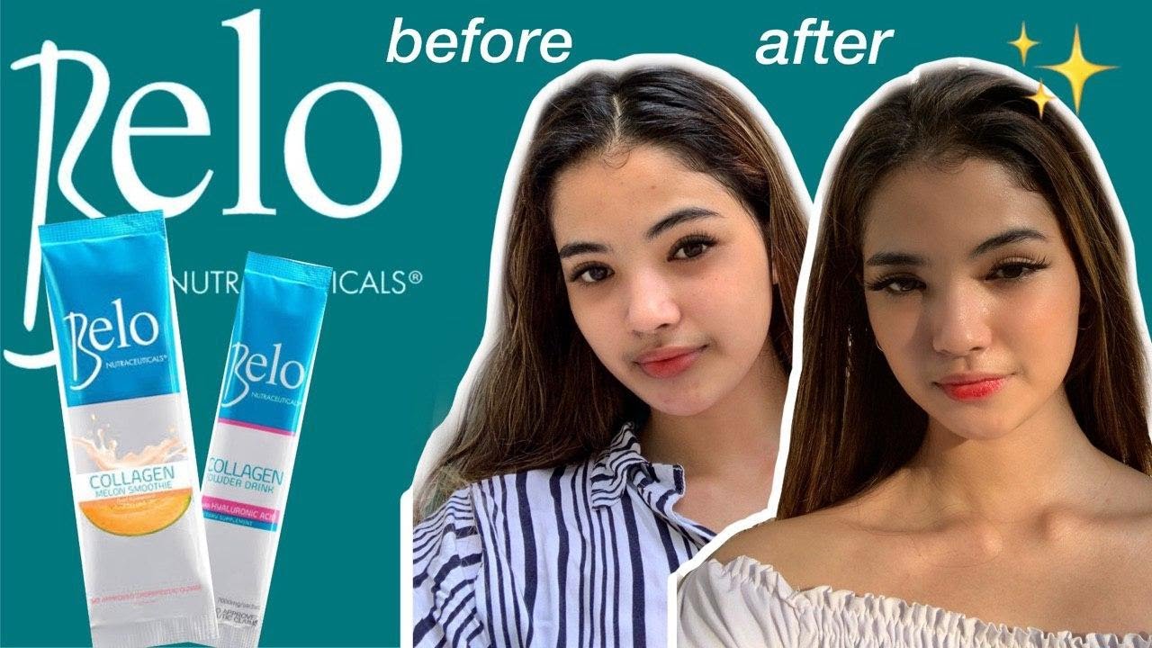 7-DAY SKIN TRANSFORMATION | BELO COLLAGEN IS MY SECRET TO GLOWING SKIN