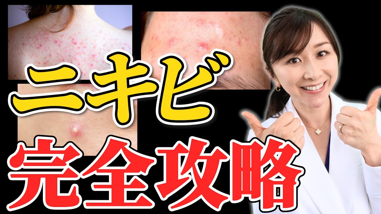 【完全版】これさえ見れば必ず良くなる！ニキビ徹底解説