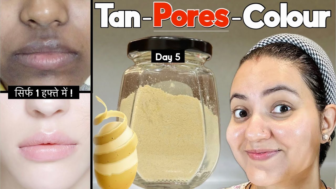 Skin Transformation Challenge (Day 5) | Remove Tanning, Open Pores, Discoloration in Just 5 Days💕