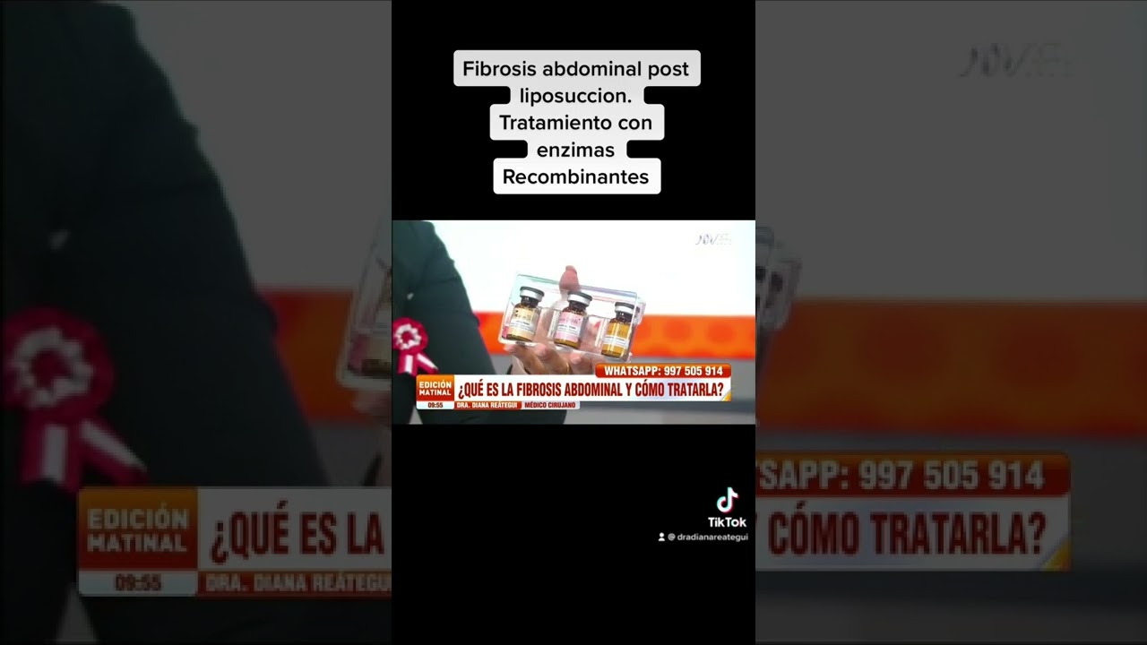 Fibrosis abdominal y tratamiento con enzimas recombinantes por ATV NOTICIAS