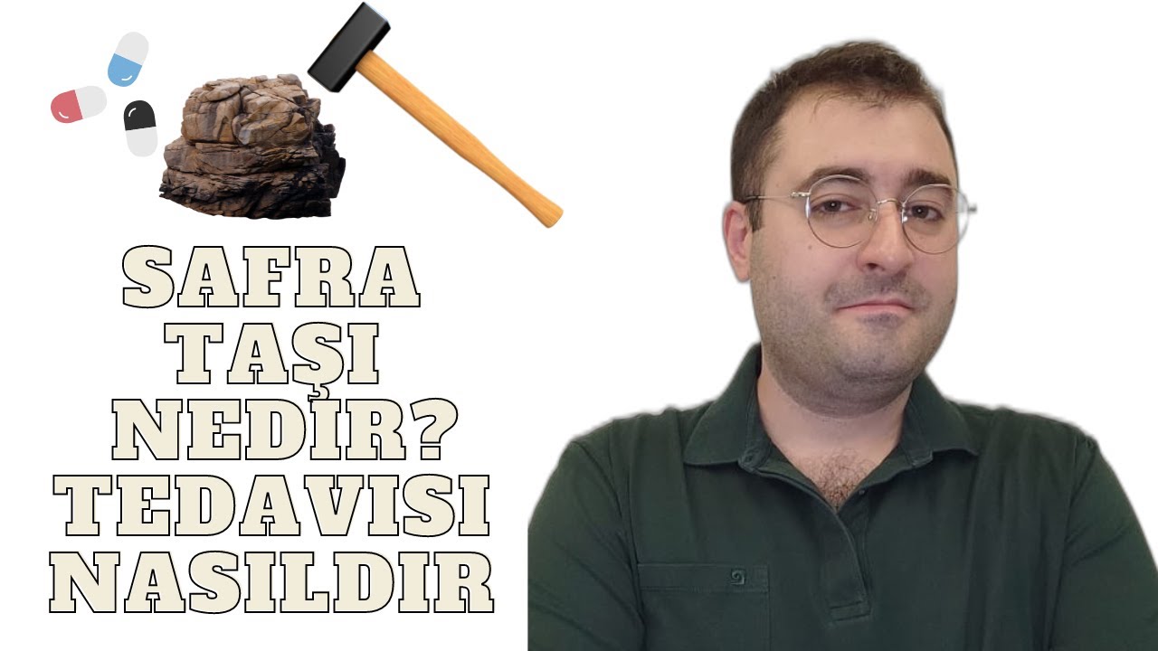 Safra Taşı ve Tedavi Yöntemleri
