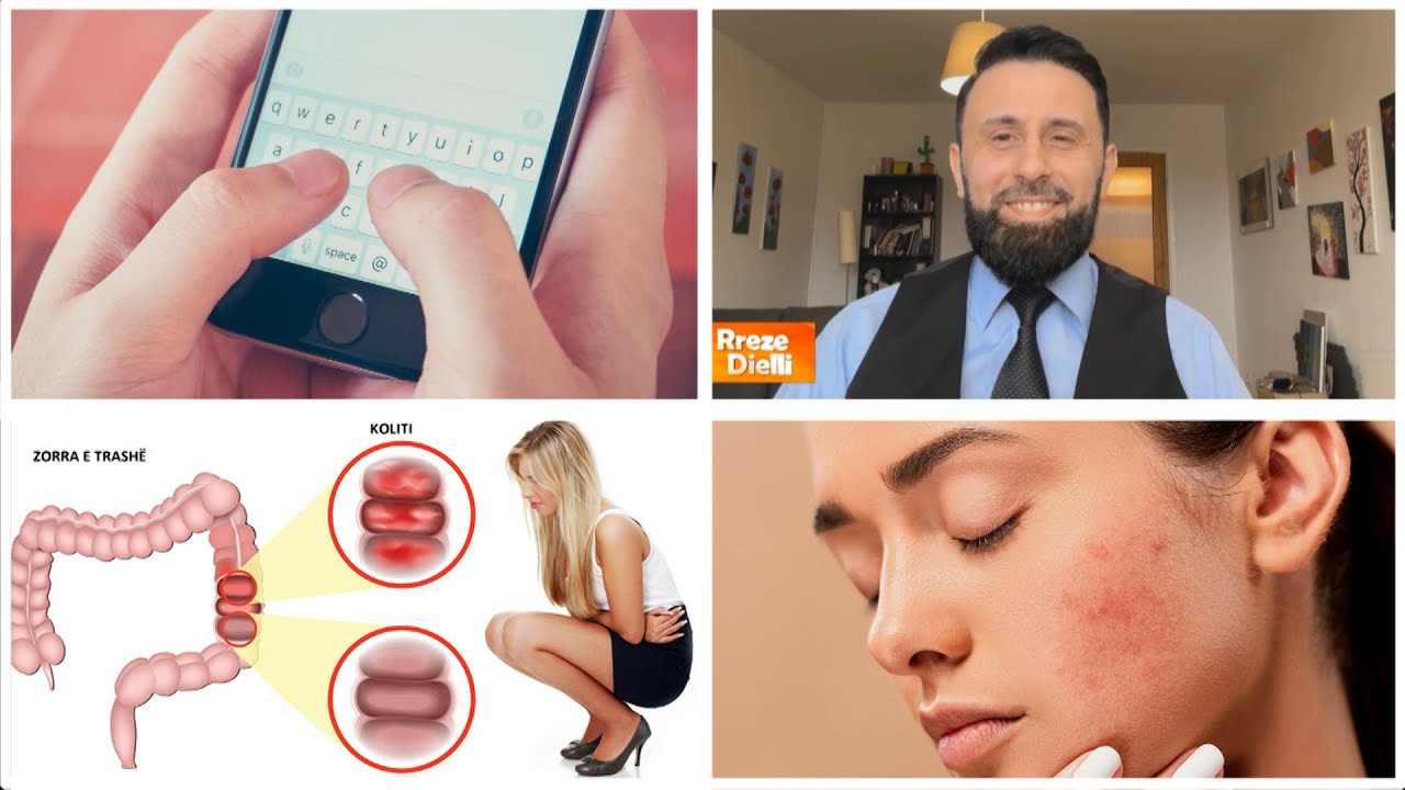Koliti, gastriti, hemorroidet, aknet...Altin Joka iu përgjigjet mesazheve të qytetarëve