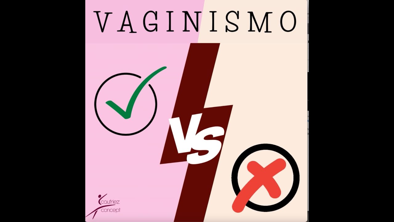 Vaginismo. Qué es? como diferenciarlo del pseudovaginismo