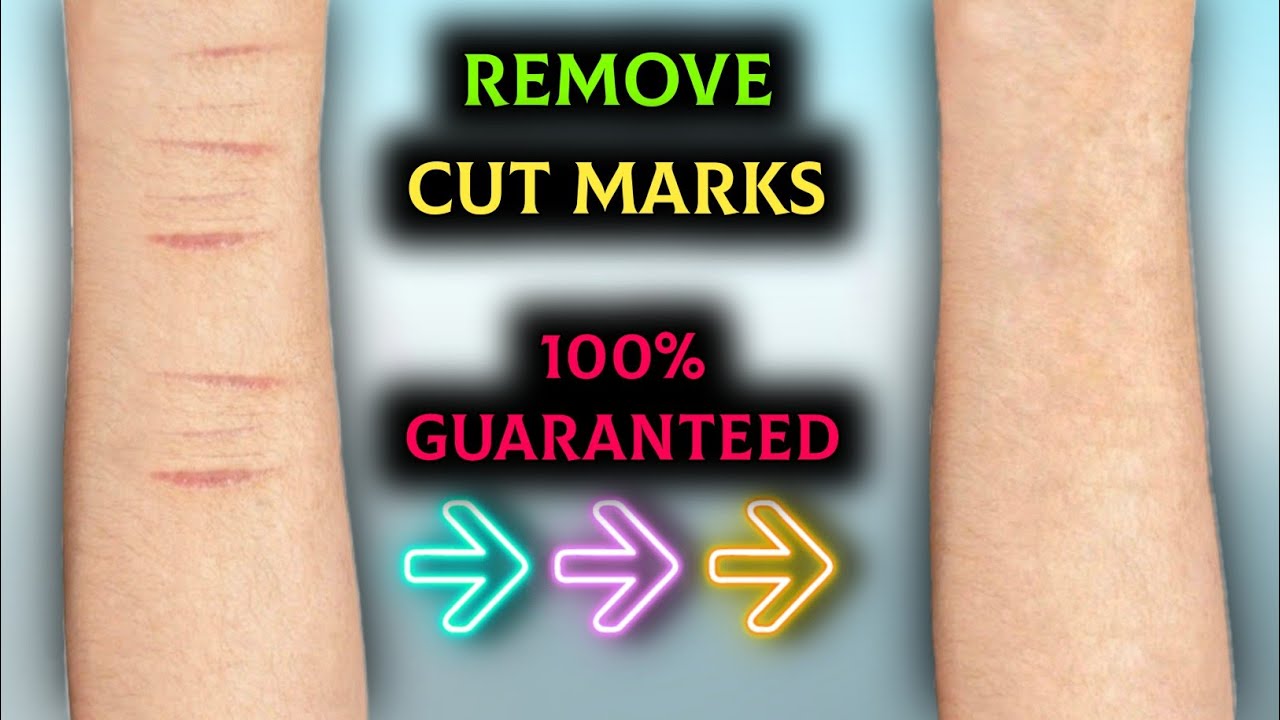 How to Remove cut marks permanently| 100% guaranteed