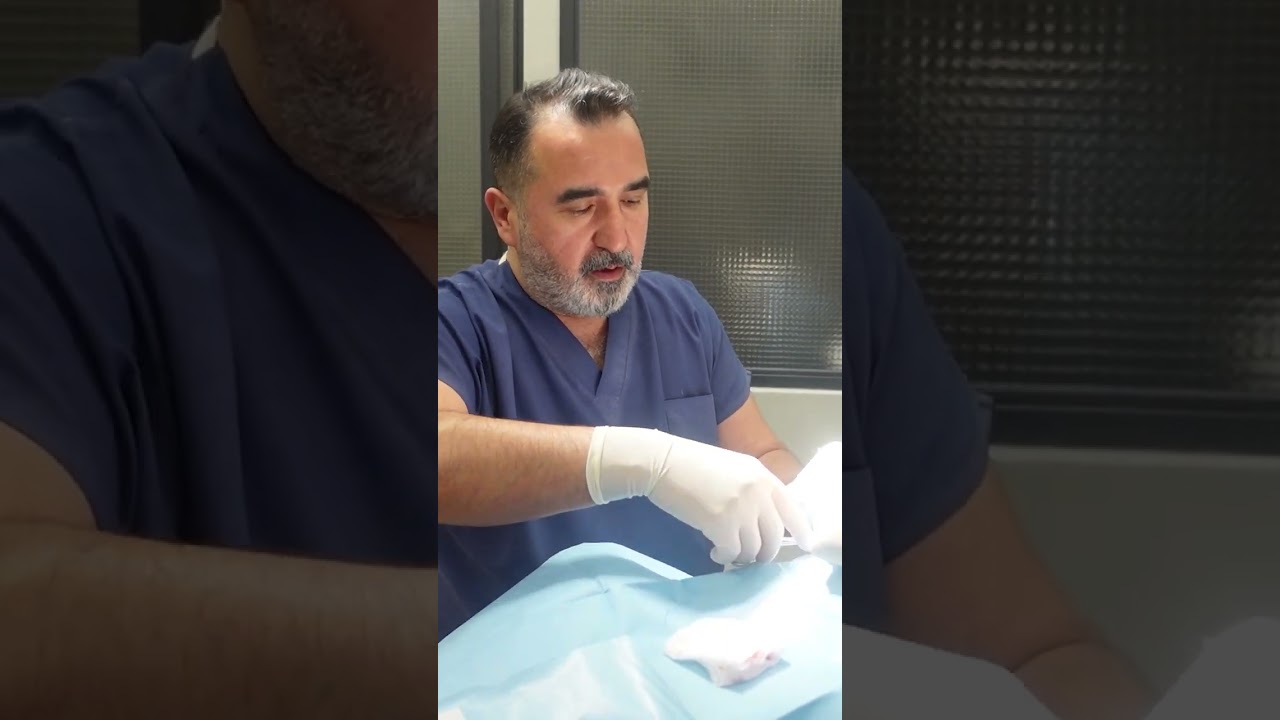 Kulak Ameliyatlarında &Ccedil;apa Tekniğinin Farkı