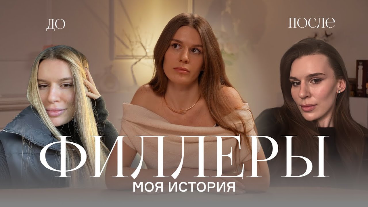 Филлеры: мой опыт, последствия