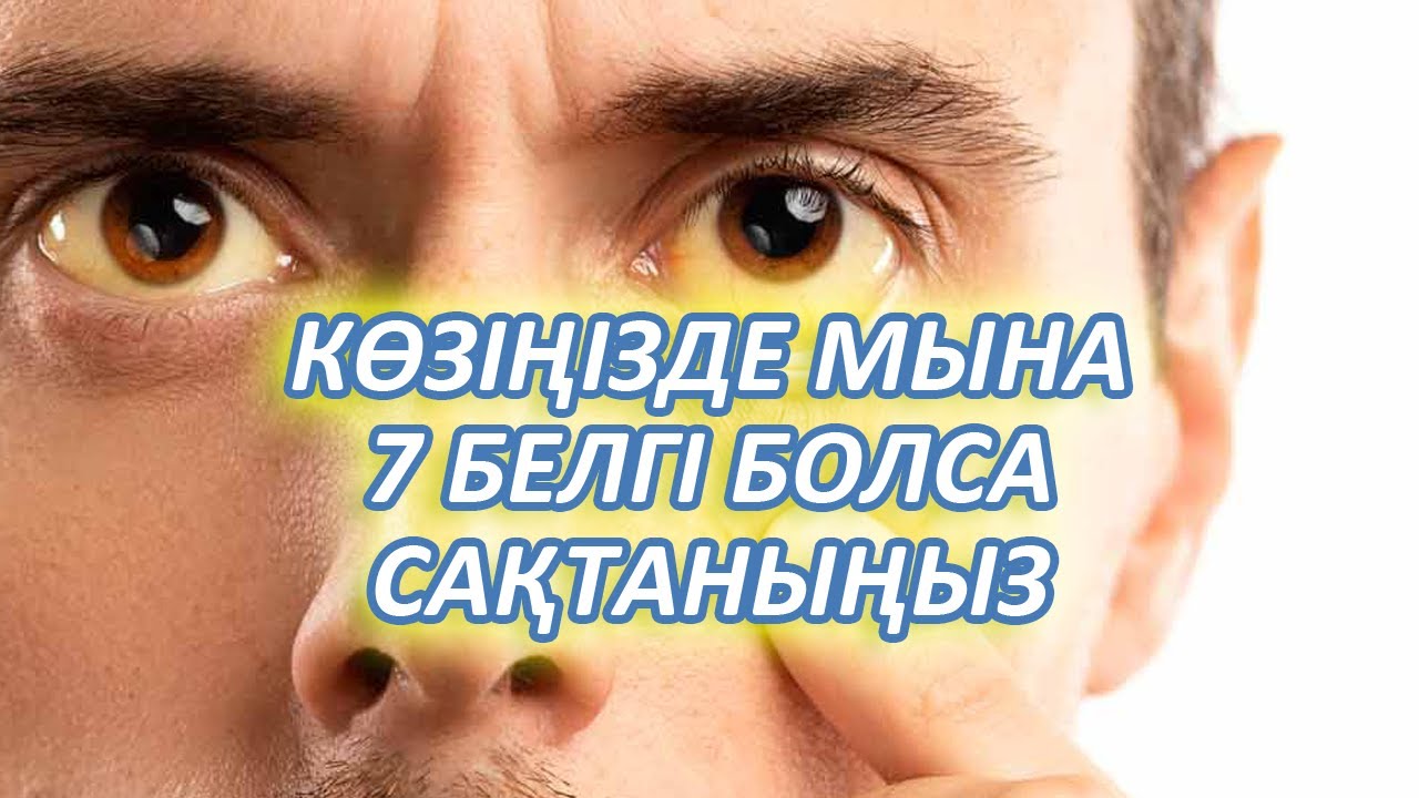 КӨЗІҢІЗДЕГІ БЕЛГІЛЕР МЫНА АУРУЛАРДАН ХАБАР БЕРЕДІ, Сарғайса, Жас ақпаса, Қызарса, Керек арнасы
