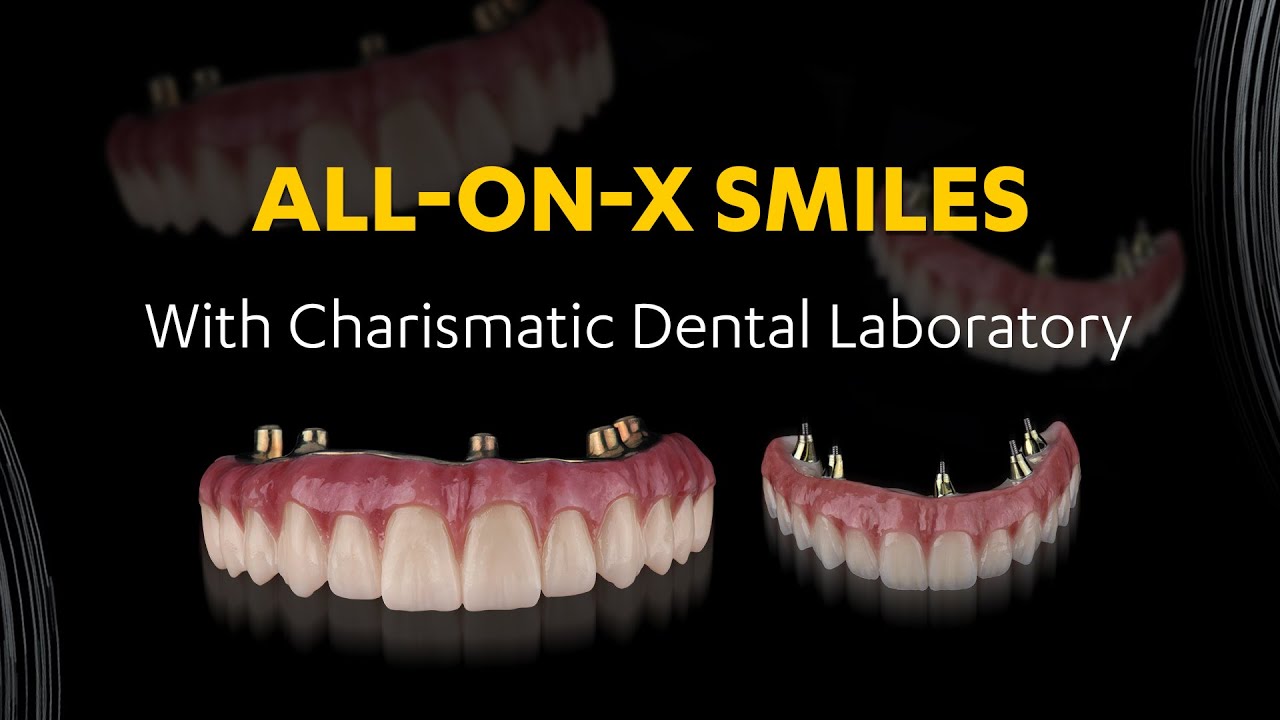 All-on-X and The 2 Step Technic by Charismatic Dental Laboratory