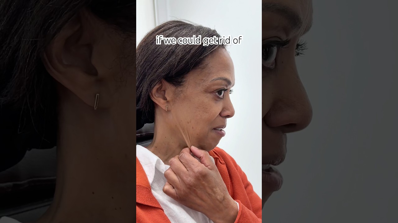 62 Years Old and THRIVING After Full Facial Rejuvenation Surgery!