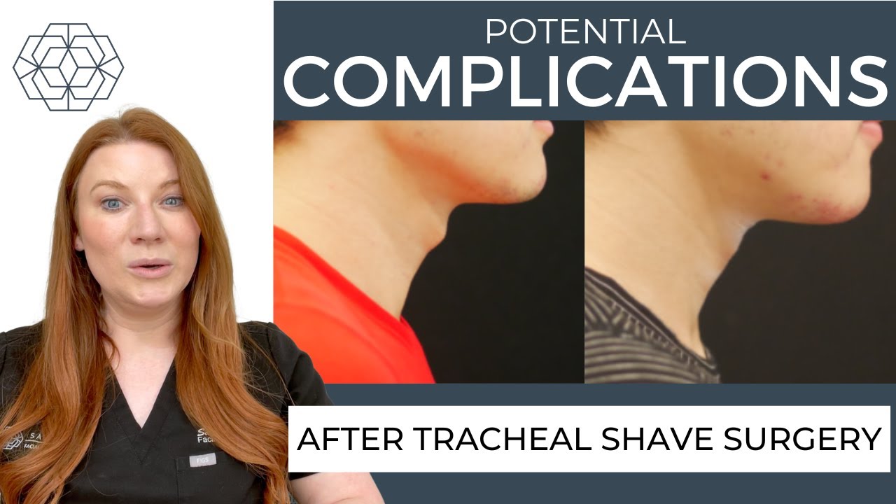 Tracheal Shave Complications Explained by Dr. Sarah Saxon | Adam's Apple Reduction Risks